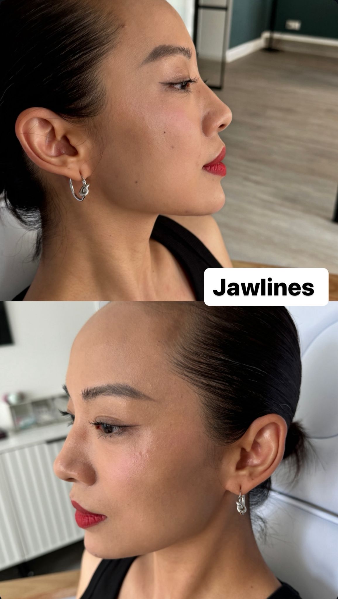 Jawline-Definition