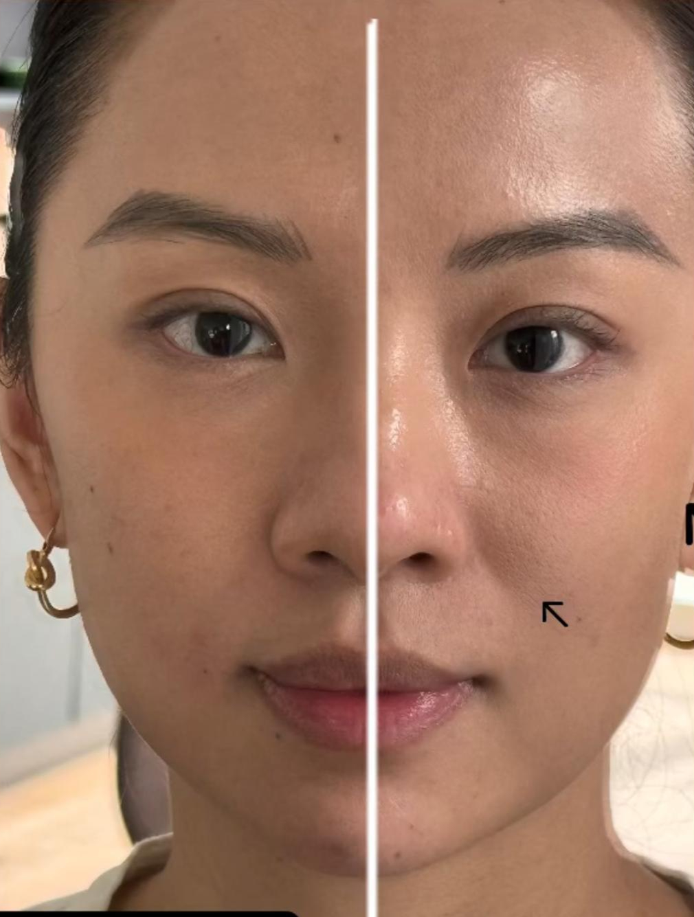 Facelift 40 Jahr und älter